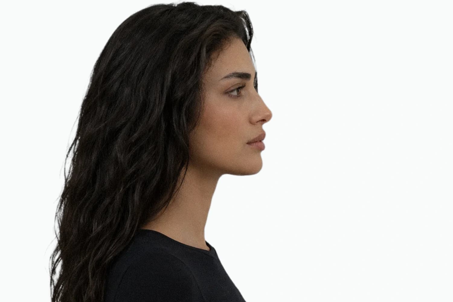 Profile portrait with an illustrative upper jaw overlay and midface support labels