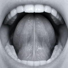 Tongue Posture